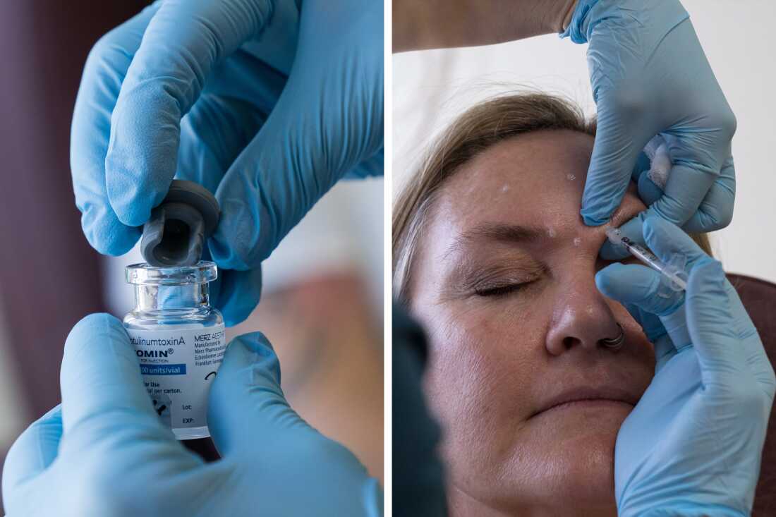 botox-diptych.jpg